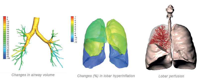 Imaging biomarkers